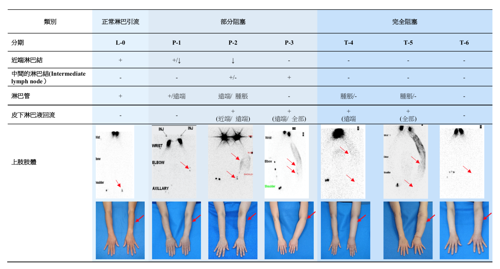 新型台灣淋巴攝影分期系統